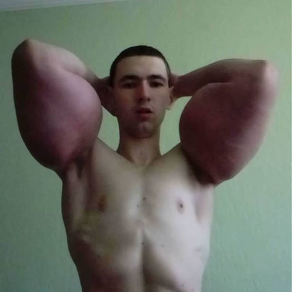 This Guy Was Ready For Everything To Become Like Popeye