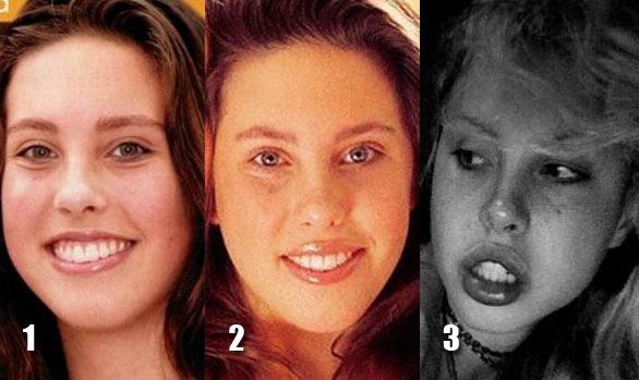 When plastic surgery fails (38 pics)