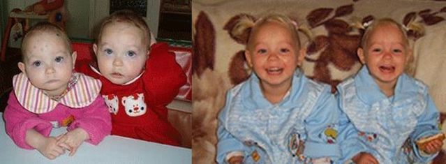 Pictures of children in orphan houses and in their new families (68 pics)