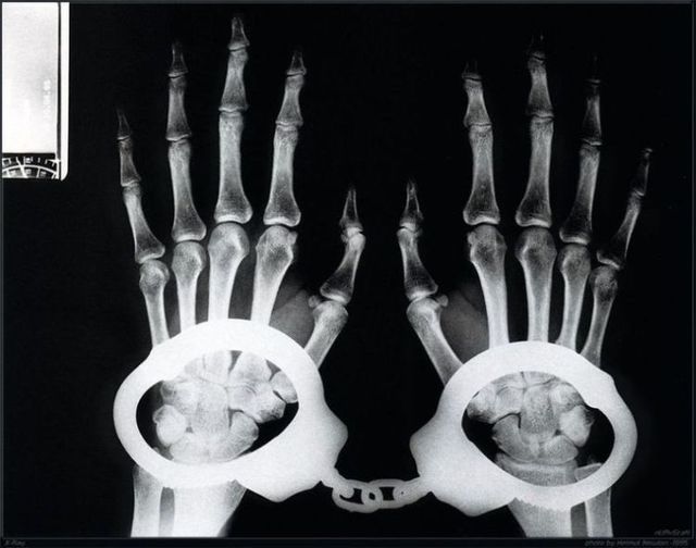 life with x-ray (59 pict)