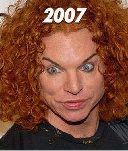 Carrot Top, another victim of plastic surgery (31 pics)