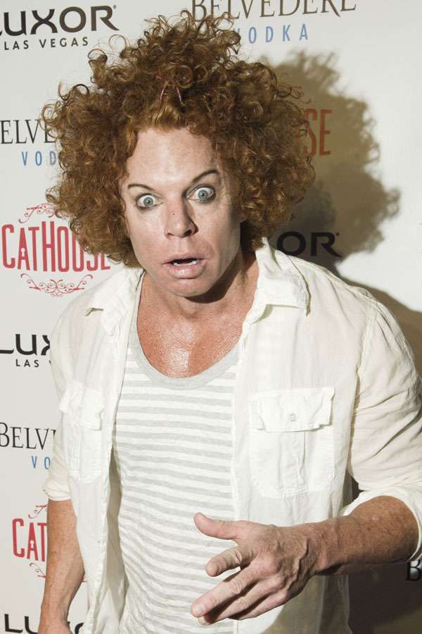 Carrot Top, another victim of plastic surgery (31 pics)
