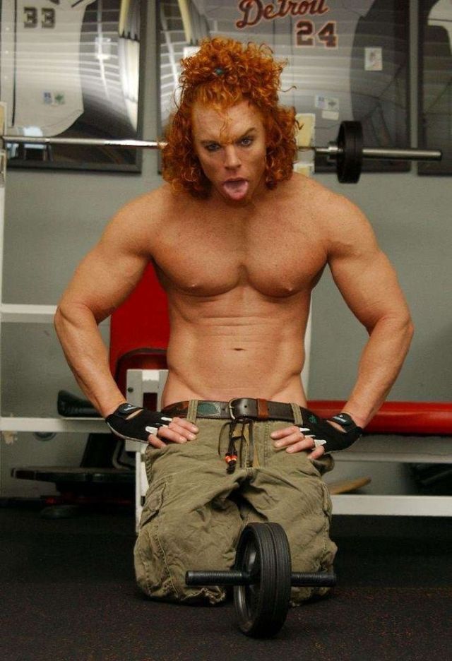 Carrot Top, another victim of plastic surgery (31 pics)