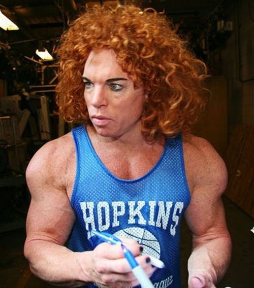 carrot top before. surgery carrot top before