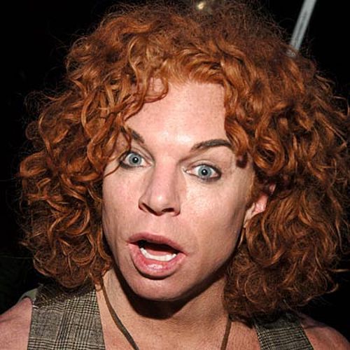 Carrot Top, another victim of plastic surgery (31 pics)