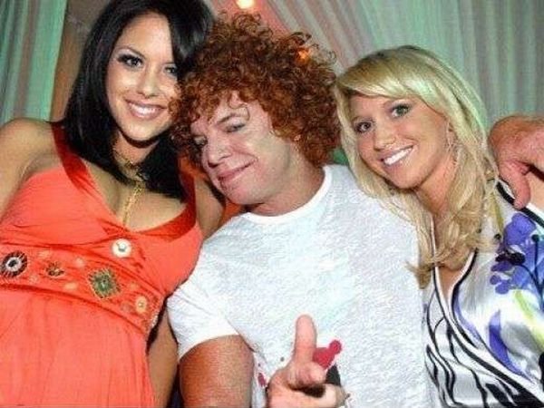 Carrot Top, another victim of plastic surgery (31 pics)
