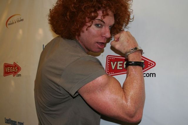 Carrot Top, another victim of plastic surgery (31 pics)