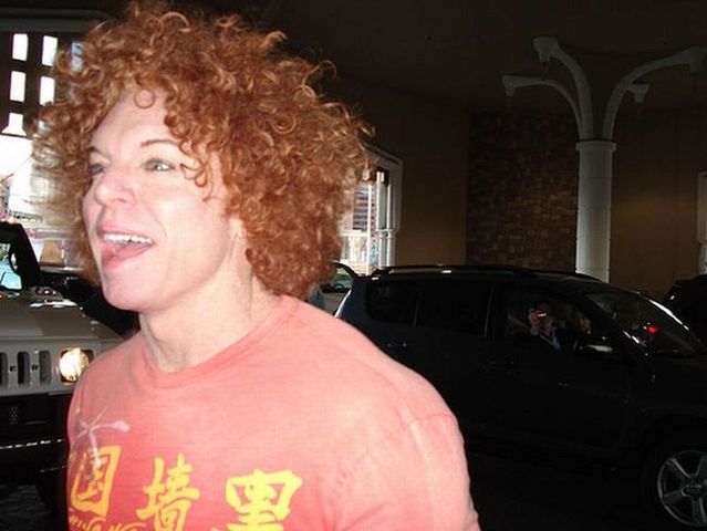 Carrot Top, another victim of plastic surgery (31 pics)