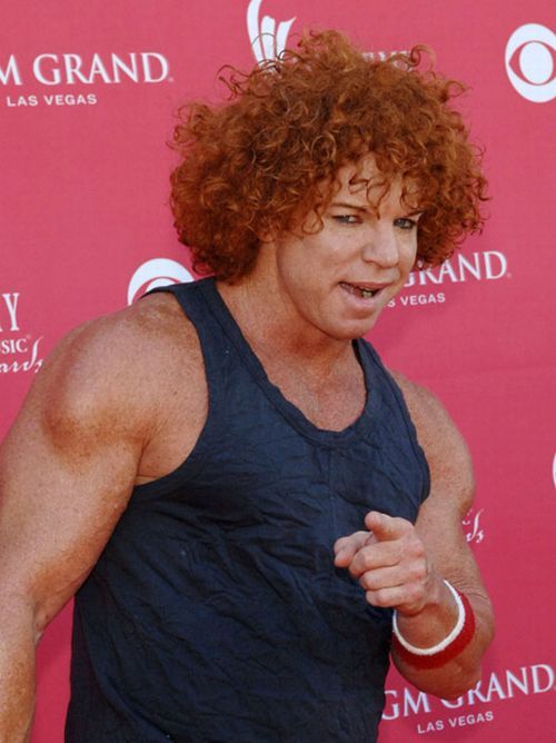 Carrot Top  another victim of plastic surgery  31 pics