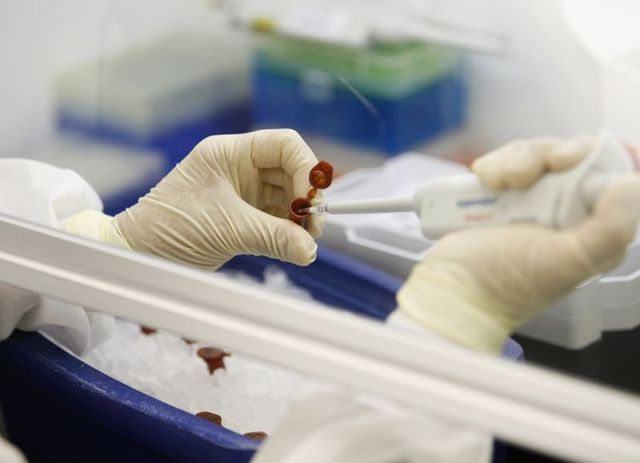 New virus has appeared. It’s called Swine flu (21 pics)