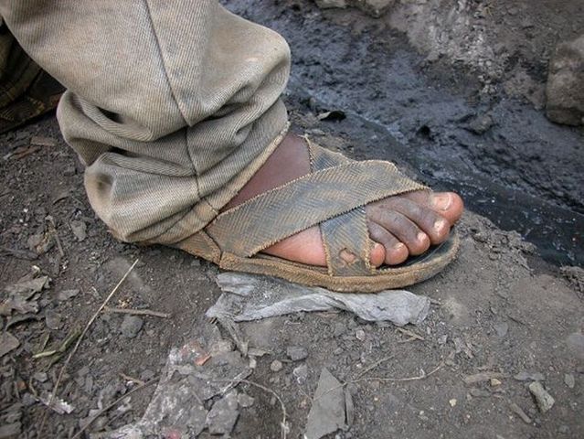 Flip-flops and toe-straps for the crisis (17 pics)