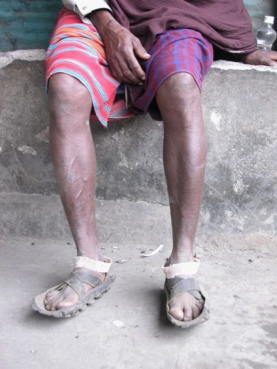 Flip-flops and toe-straps for the crisis (17 pics)