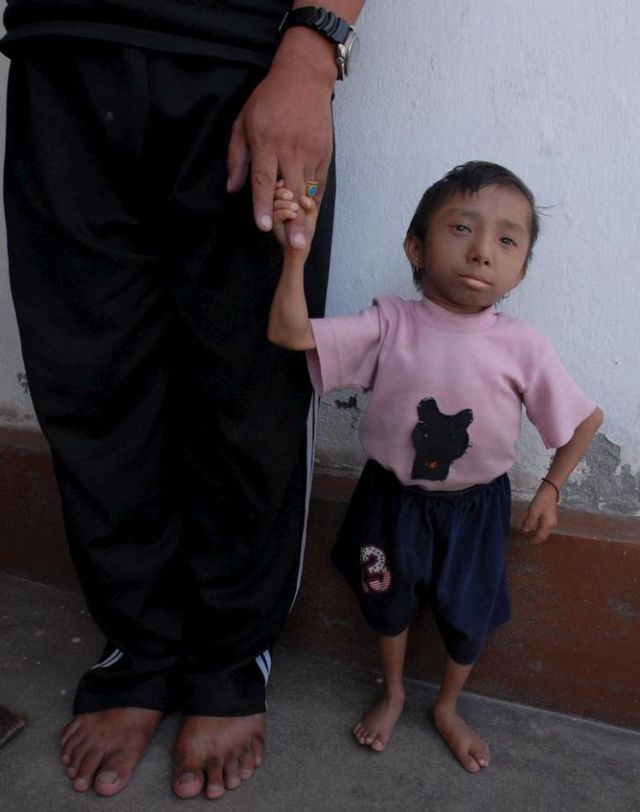 The World's Smallest Man (14 pics)