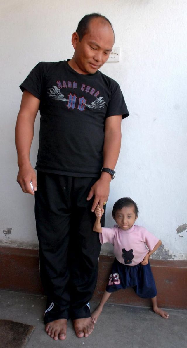 The World's Smallest Man (14 pics)
