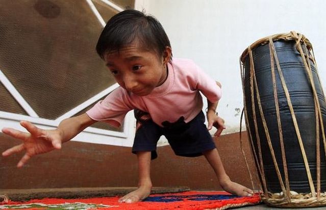 The World's Smallest Man (14 pics)