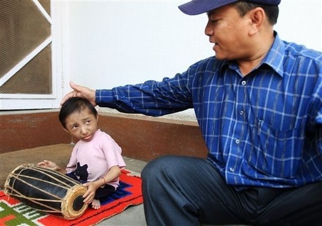 The World's Smallest Man (14 pics)