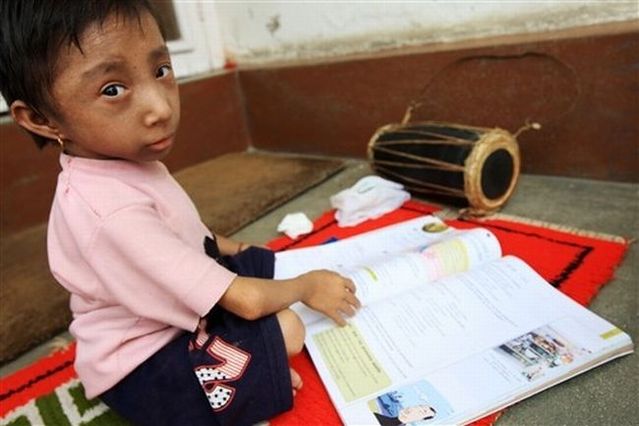 The World's Smallest Man (14 pics)