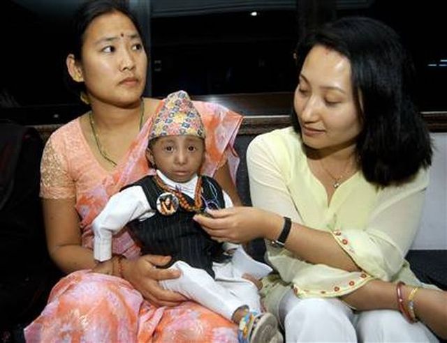 The World's Smallest Man (14 pics)