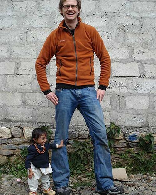 The World's Smallest Man (14 pics)