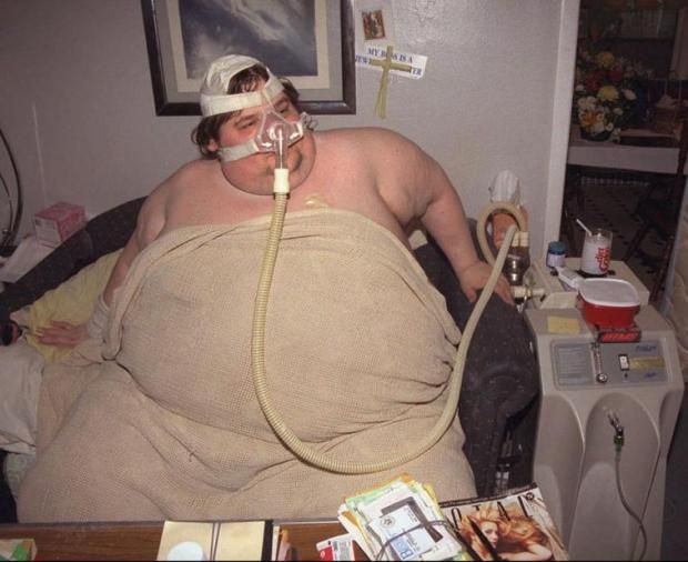 He lost his weight considerably and several years later, he ballooned back (5 pics)