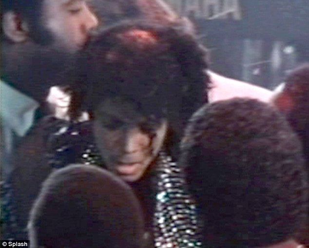 Michael Jackson’s hair on fire in Pepsi advert (12 pics + 1 video)