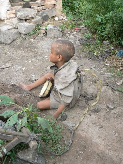 The most horrific methods of begging (4 pics)