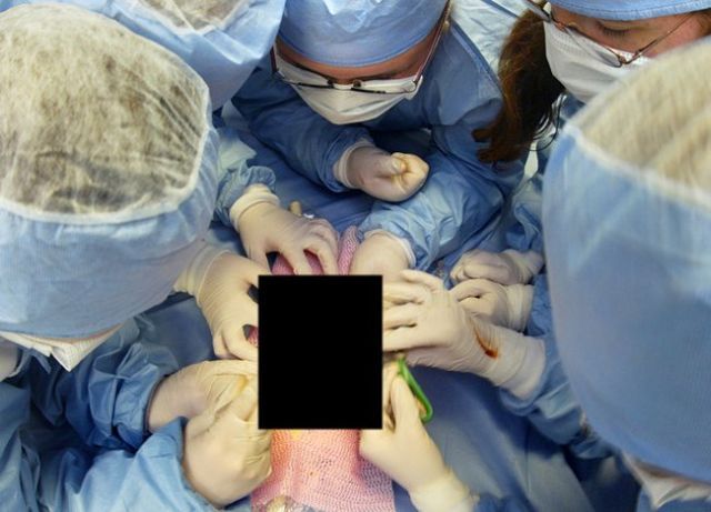 The first in the world complete double arm transplant (13 pics)