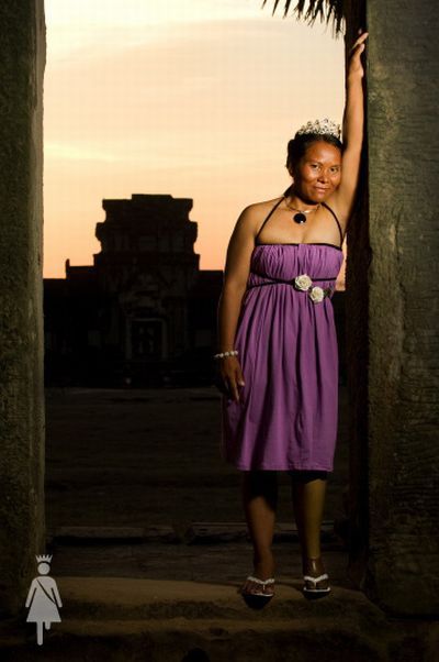 The beauty contest for disabled women (20 pics)