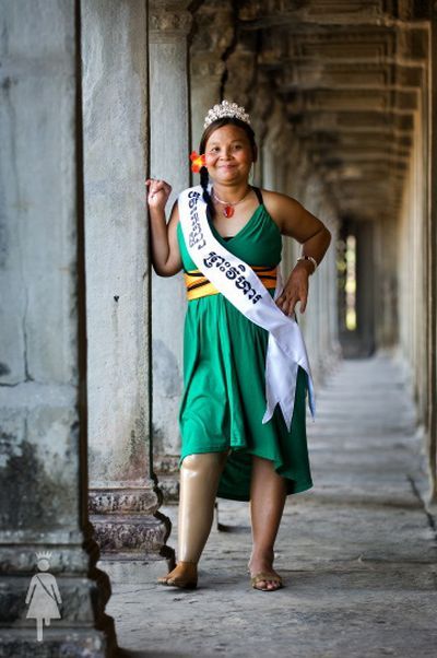 The beauty contest for disabled women (20 pics)