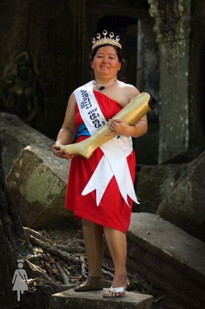 The beauty contest for disabled women (20 pics)