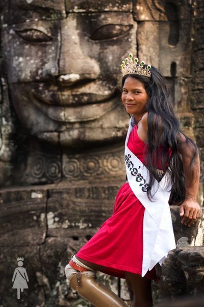 The beauty contest for disabled women (20 pics)