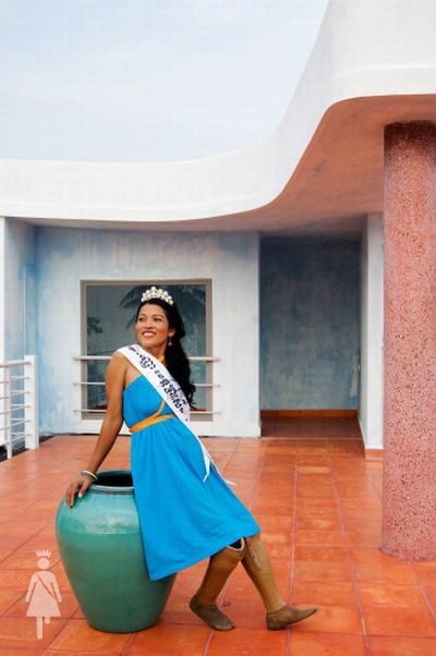 The beauty contest for disabled women (20 pics)