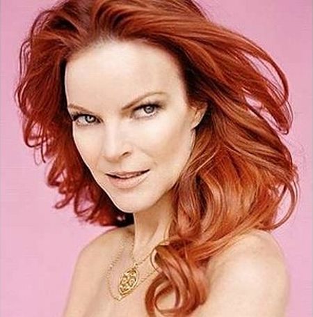Celebrities with big foreheads (20 pics)