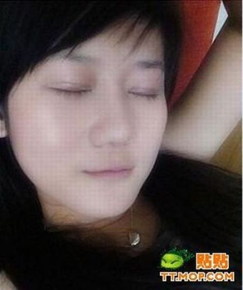 Plastic surgery is for all ages? (18 pics)