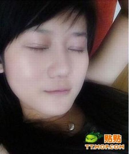 Plastic surgery is for all ages? (18 pics)