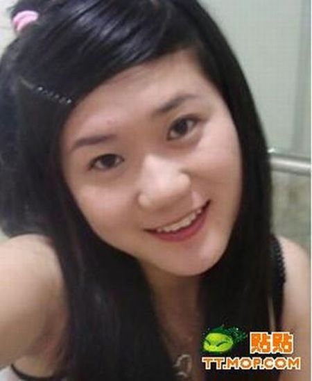 Plastic surgery is for all ages? (18 pics)