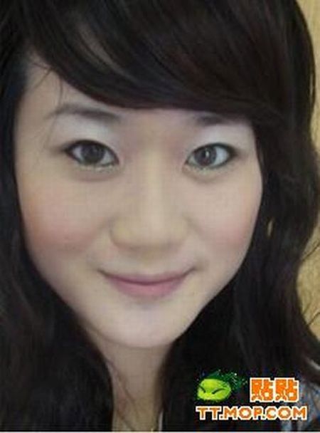 Plastic surgery is for all ages? (18 pics)