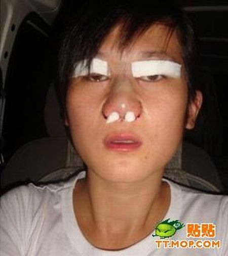 Plastic surgery is for all ages? (18 pics)