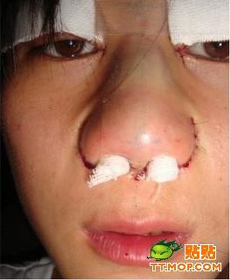 Plastic surgery is for all ages? (18 pics)