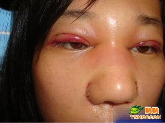 Plastic surgery is for all ages? (18 pics)