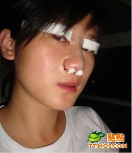 Plastic surgery is for all ages? (18 pics)