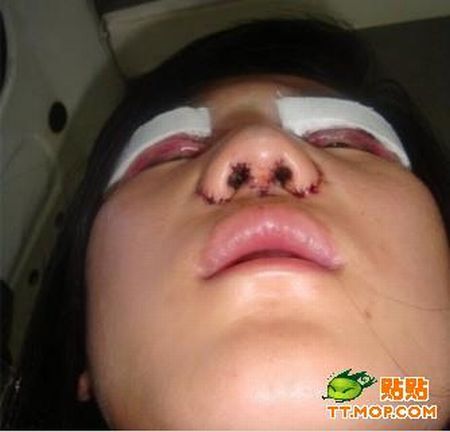 Plastic surgery is for all ages? (18 pics)