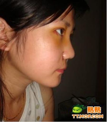 Plastic surgery is for all ages? (18 pics)