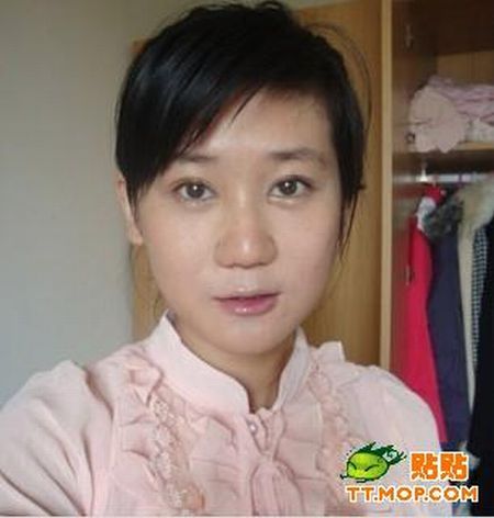 Plastic surgery is for all ages? (18 pics)