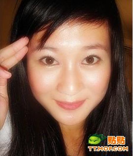 Plastic surgery is for all ages? (18 pics)