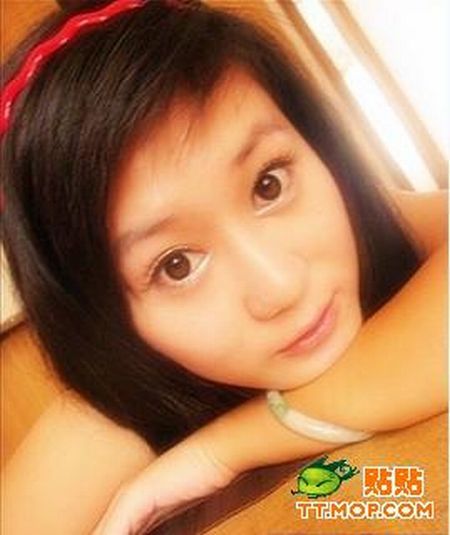 Plastic surgery is for all ages? (18 pics)