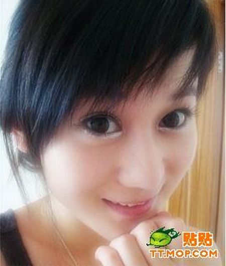 Plastic surgery is for all ages? (18 pics)