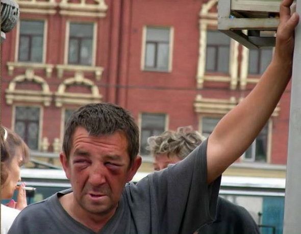 Homeless (32 pics)