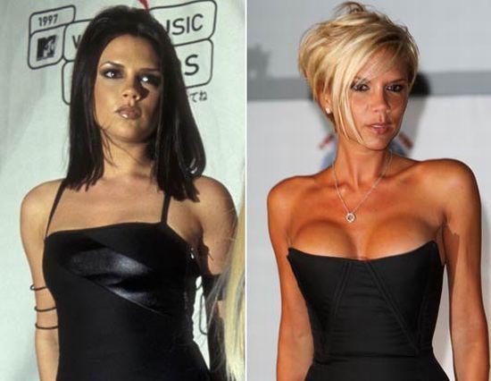 Victoria Beckham: before and after (23 pics)