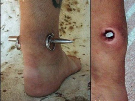 Stupid and weird body modifications (8 pics)